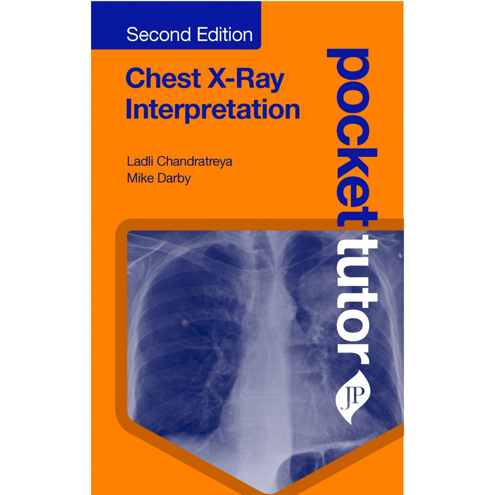 Pocket Tutor Chest X Ray Interpretation 2nd Edition 2020 By Ladli